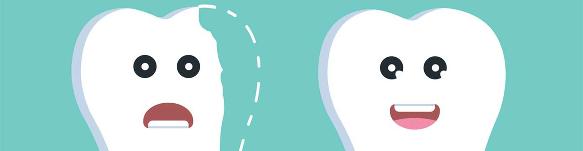 Cartoon of two teeth, one smiling and one chipped with a frown