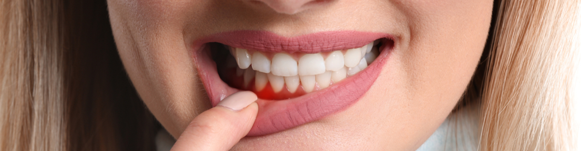 Woman holding down her mouth and showing bleeding gums