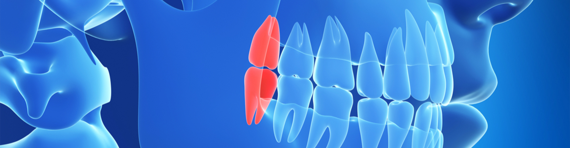 mouth x-ray