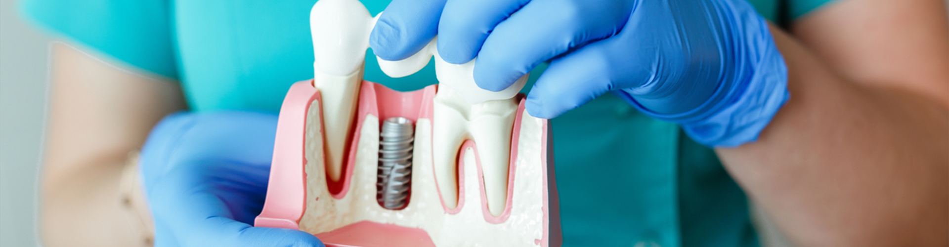 Dentist holding fake tooth display with a screw for implant 