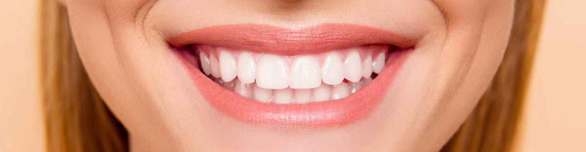 woman smiling with white teeth 