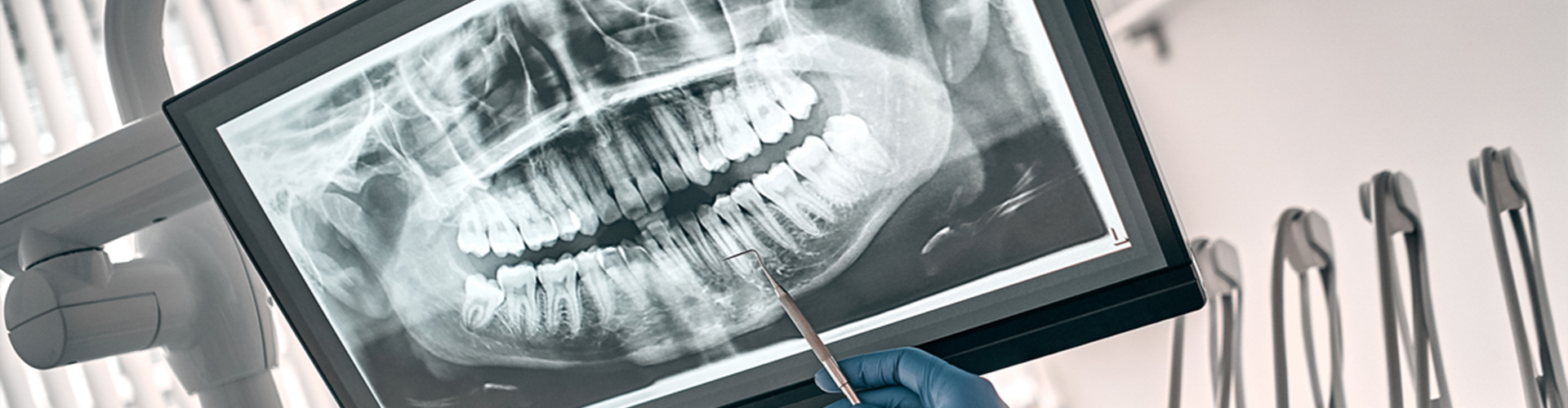 screen with an x-ray and hand pointing to it