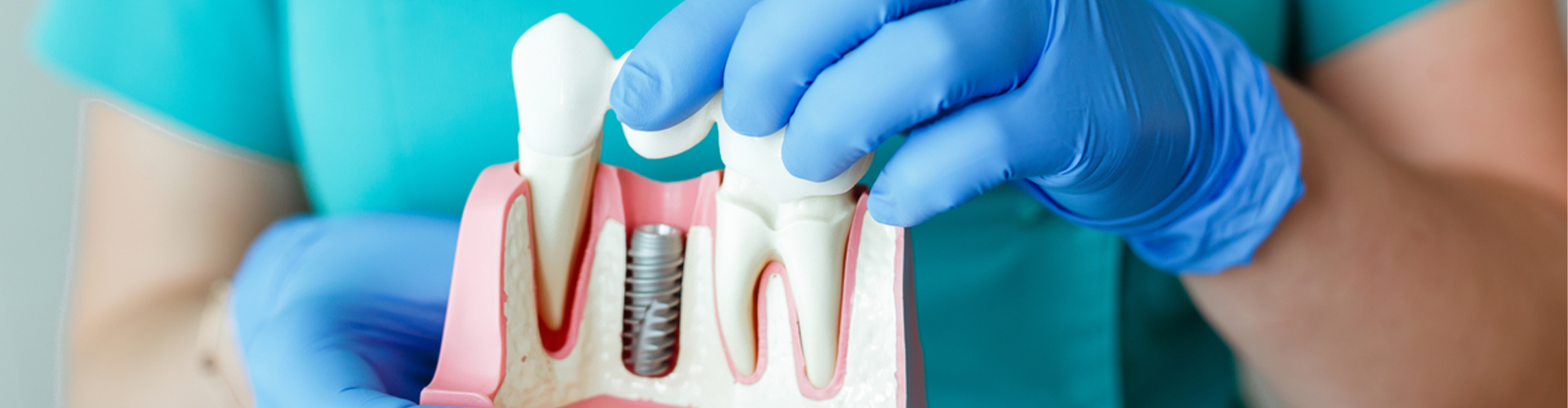 Plastic tooth display with implant