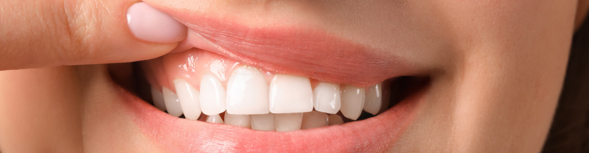 woman revealing healthy gums