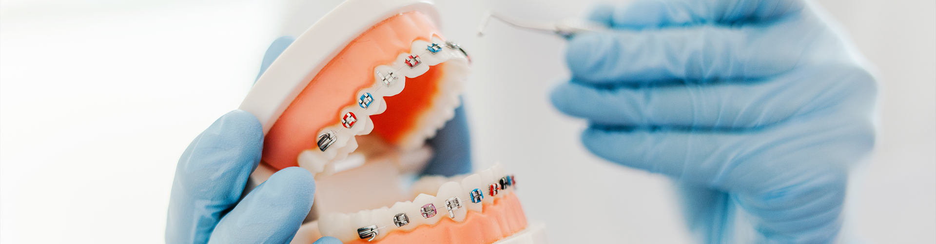 gloved hands holding mouth model with braces