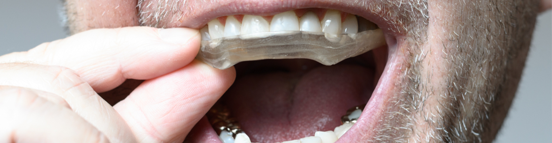 man putting in guards in his teeth 