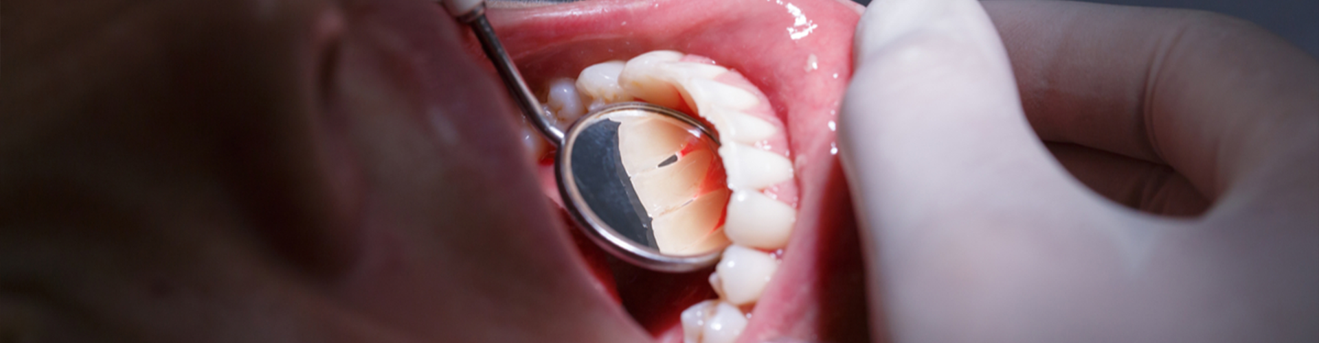 Small mirror inside of a mouth