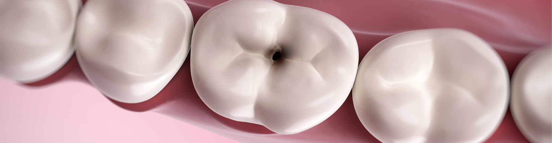 Animated tooth with black hole in it