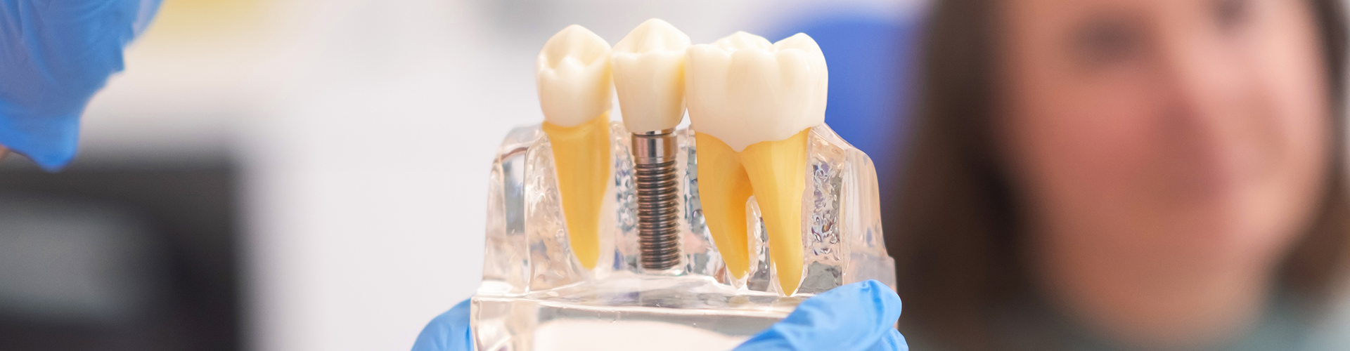 gloved hand holding an implant between two teeth in an acrylic jaw