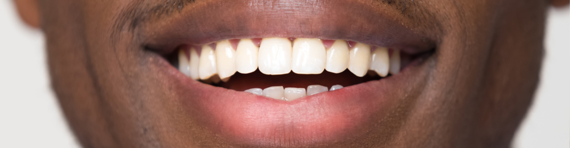 Man smiling with strait white teeth
