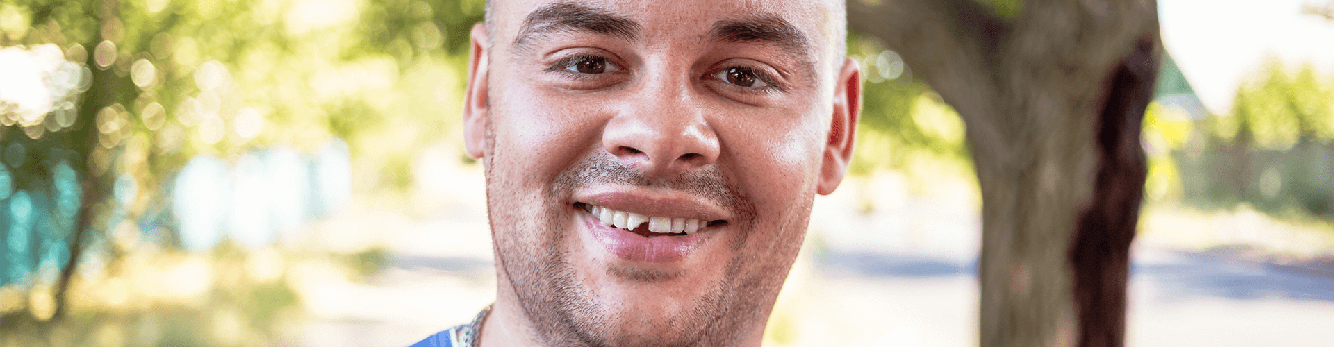 Man with a chipped tooth.