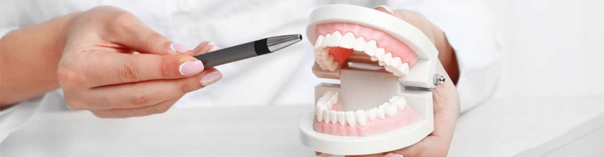 Fake mouth and tooth display.