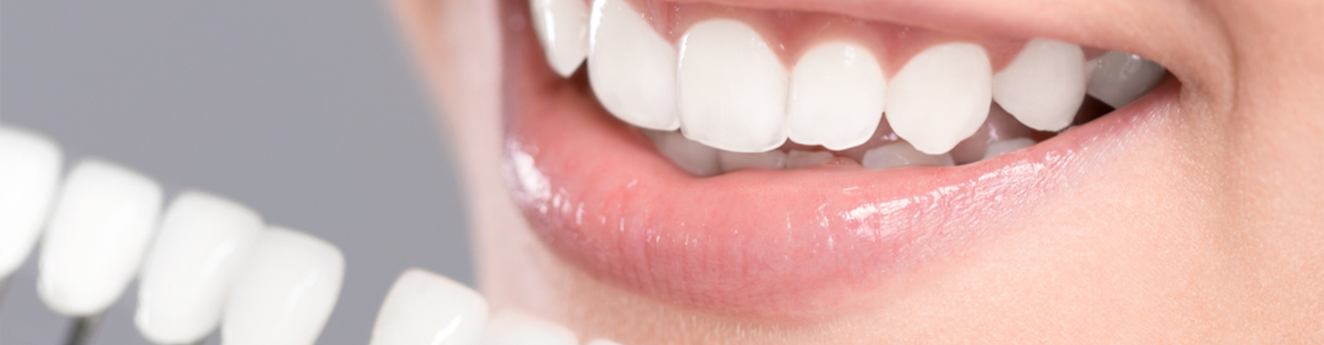White smile with fake teeth color matching kit 