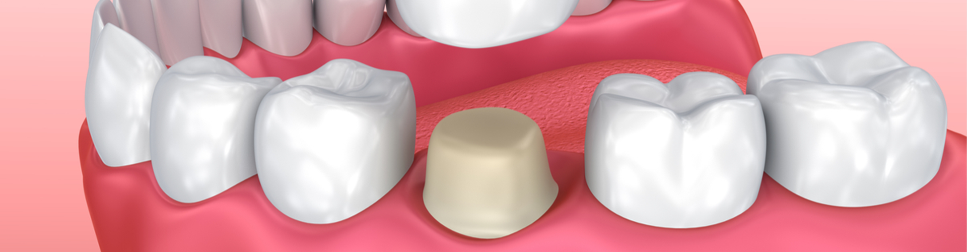 Mouth with tooth and crown above it