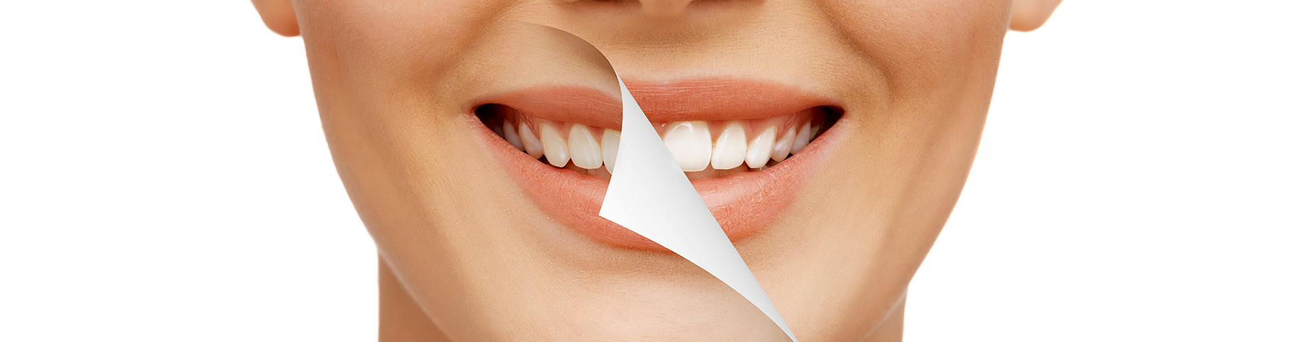 image of a woman's dark smile being peeled away to reveal a lighter one after teeth whitening
