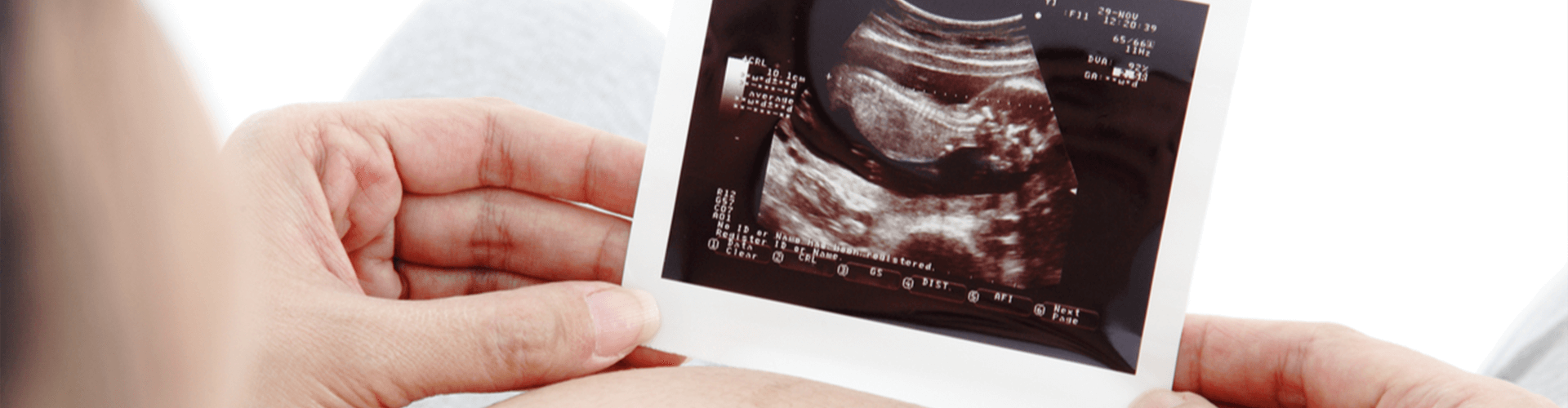 Pregnant woman holding her ultrasound.