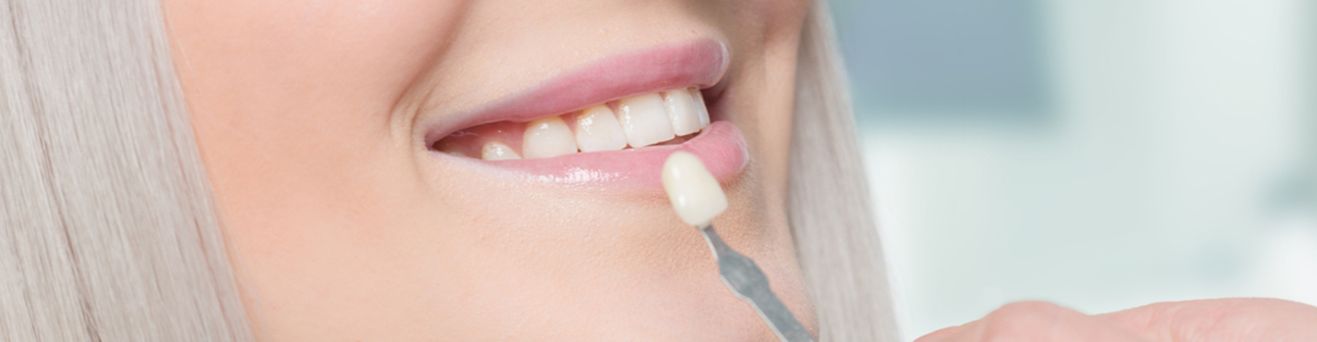 comparing veneer shade to a patient's teeth