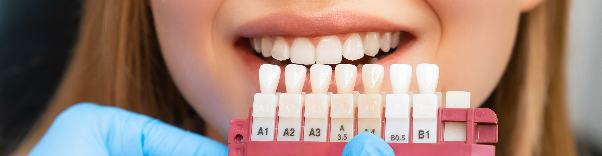 gloved hands holding shadematching tool next to woman's teeth