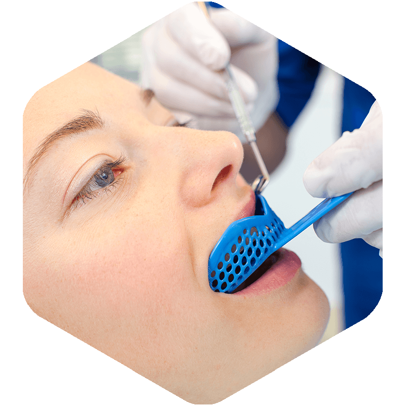 Doctor taking a dental impression of the patient’s teeth.