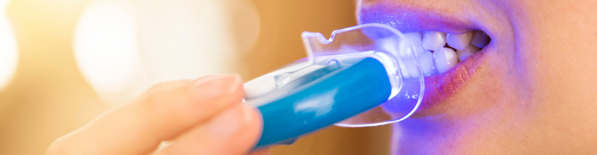 woman undergoing teeth whiteing