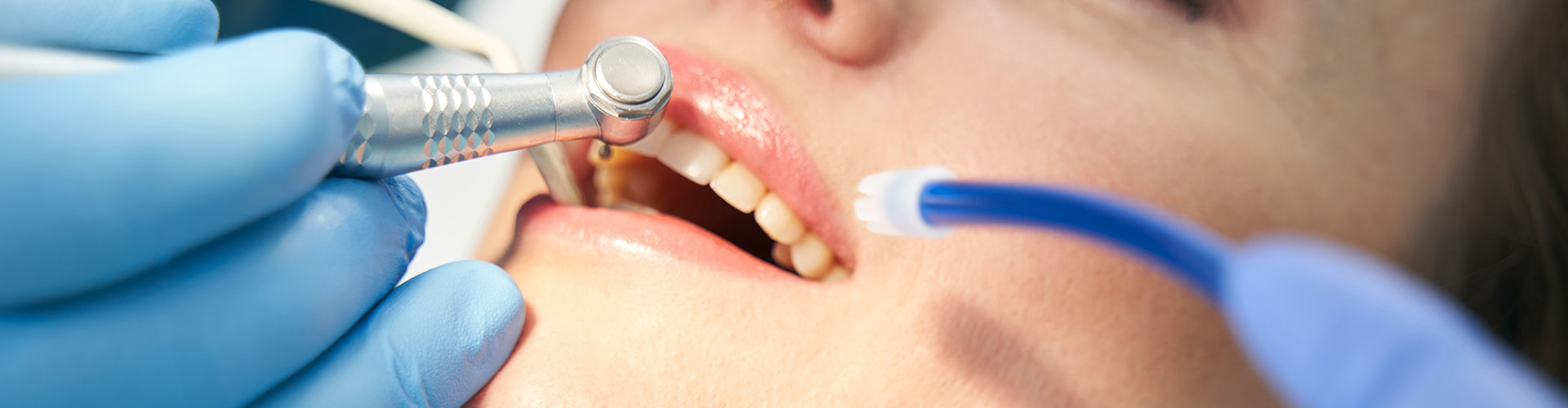 dentist using dental tools in a female's mouth