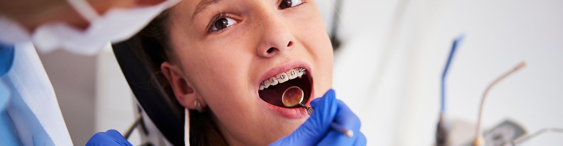 dentist holding a dental mirror in a child's mouth wearing braces