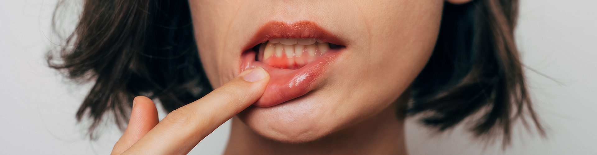 woman pulling down lip to show gums