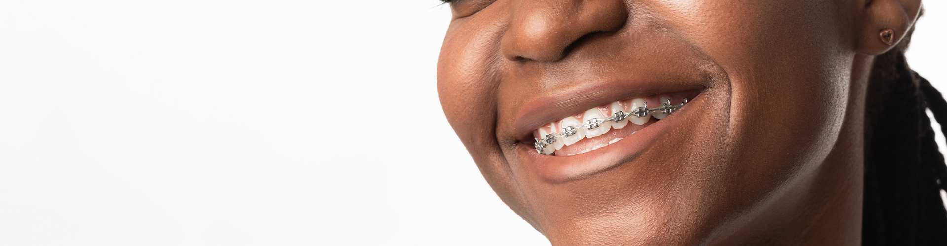 woman smiling with braces