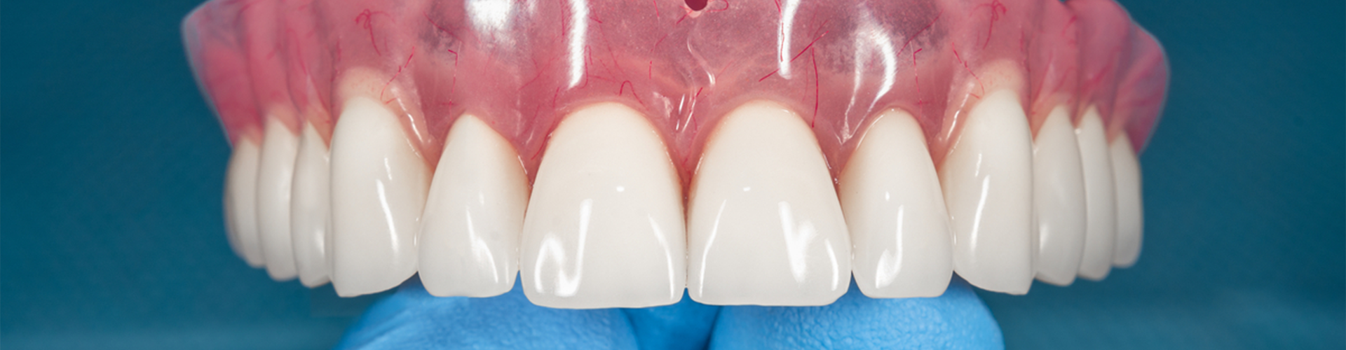 Dentures held in hand