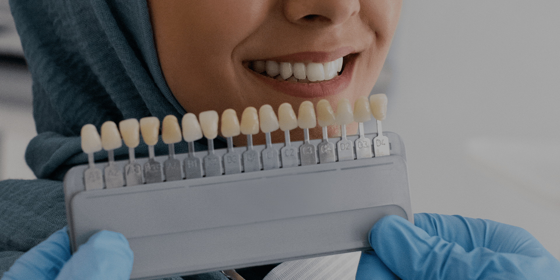 Woman smiling with veneers displayed in front of his teeth.