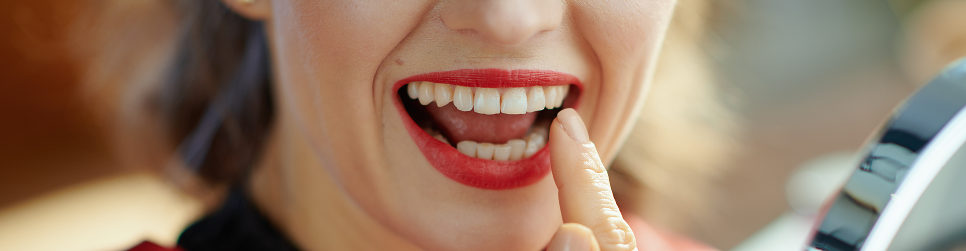 woman pointing at her upper teeth