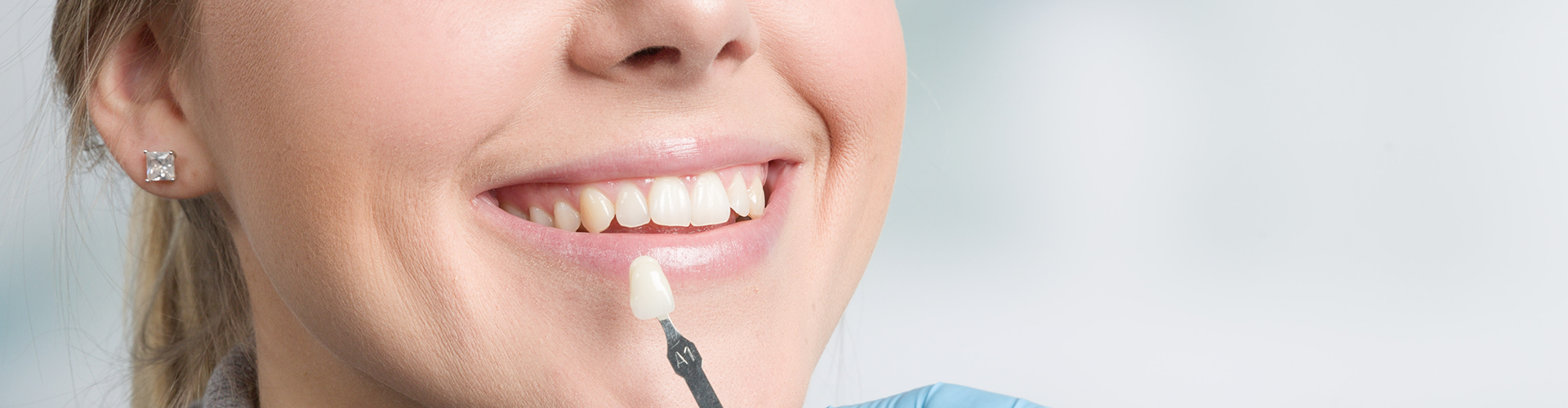 dentist holding veneer in front of patient's mouth