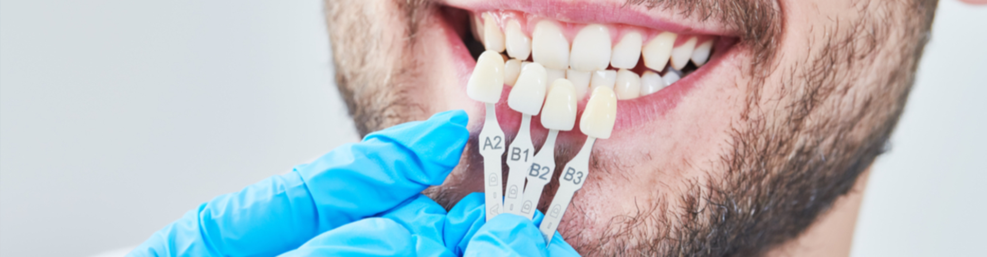 man smiling with different color fake teeth held up to his