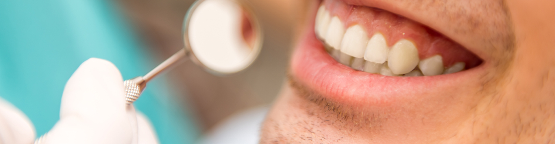 Smile with a mini mirror held up to the teeth