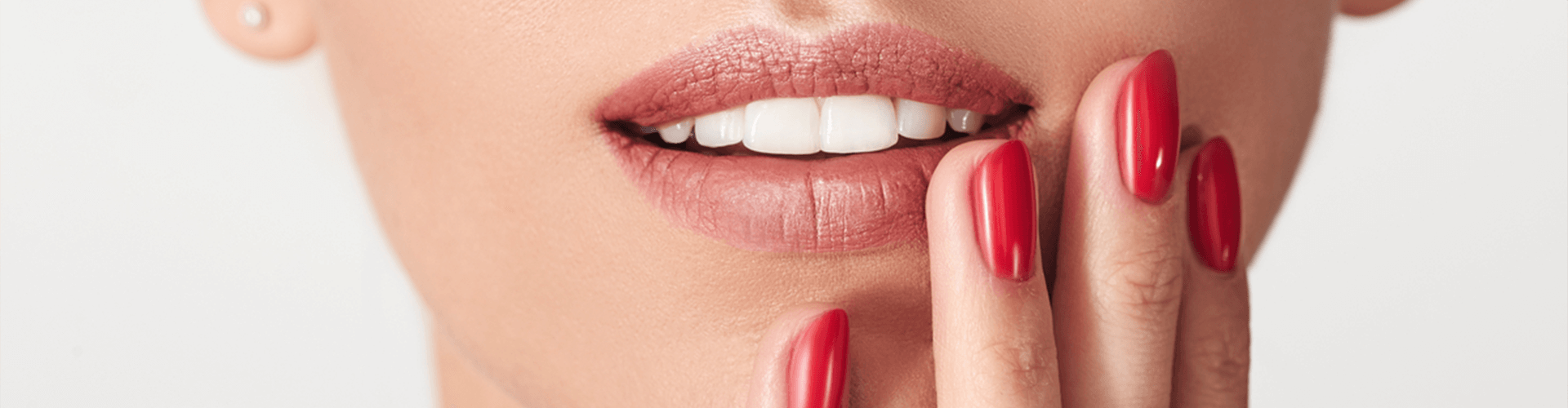 Smile make over
