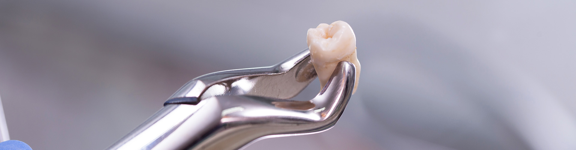 dental pliers holding an extracted tooth