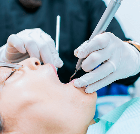 Tooth Extraction in Long Beach | Long beach Family Dentist