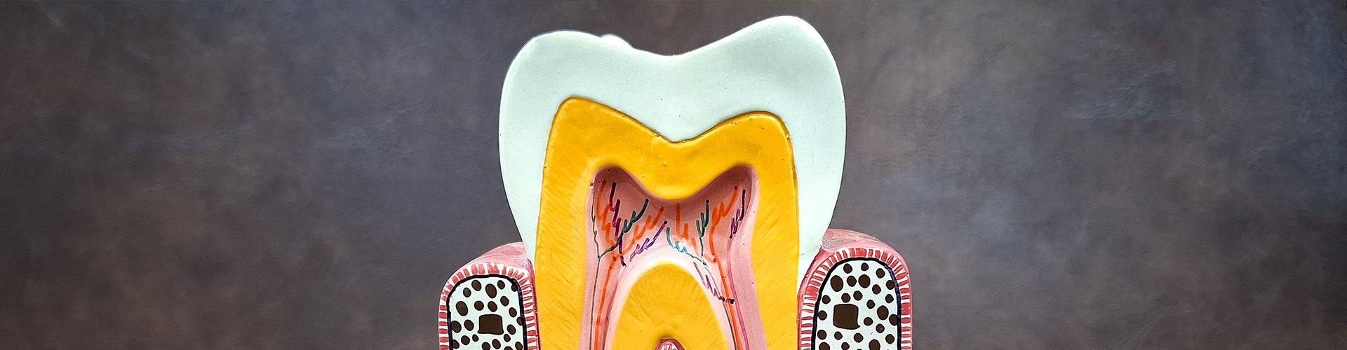 model of a tooth cut in half to show the inside