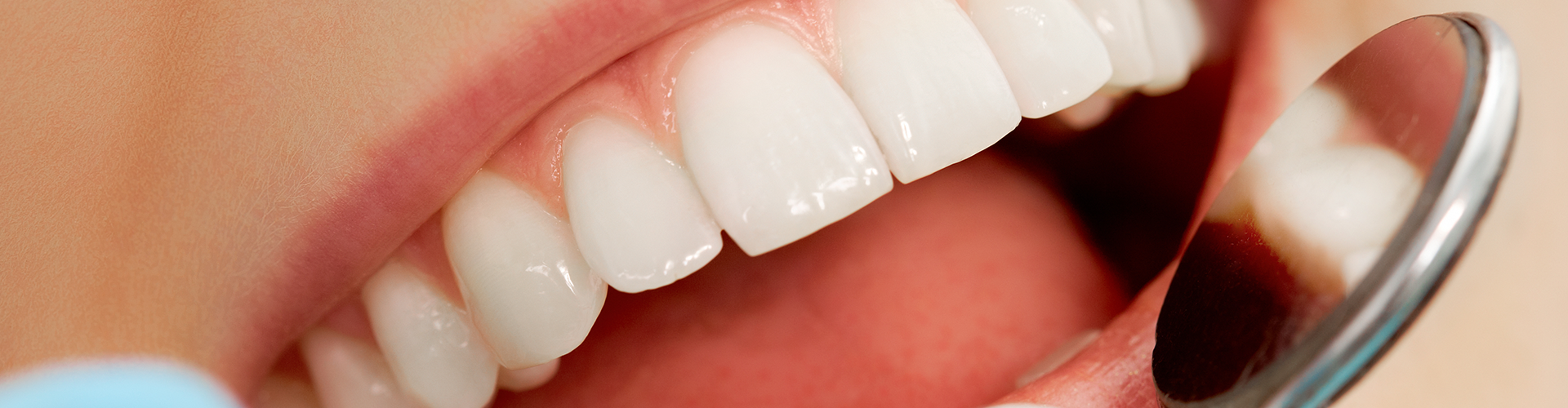 dental mirror being held in front of a smile