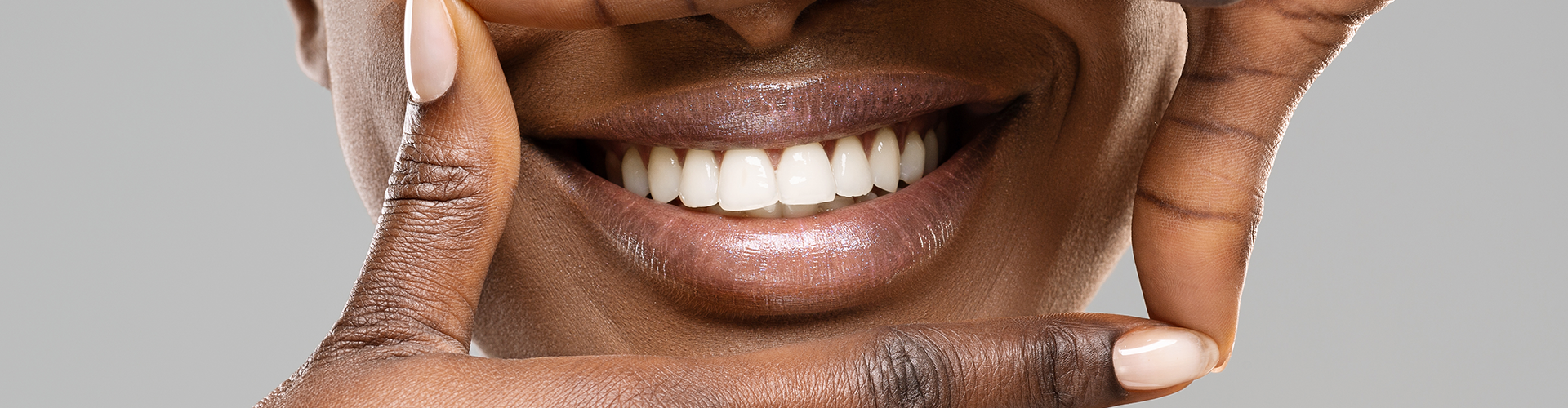 woman framing her smile with her hands