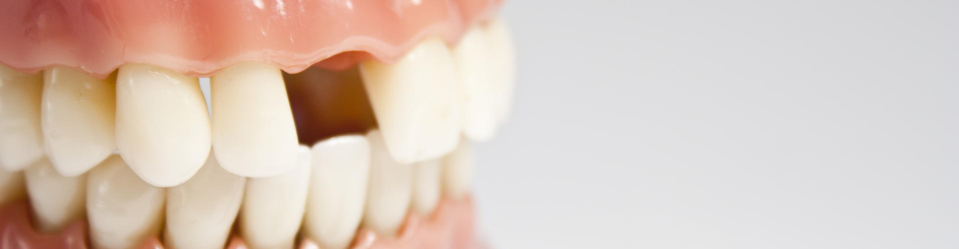 mouth model with a missing tooth